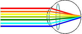 無水晶体眼イメージ図